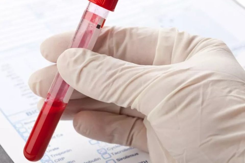 Iron deficiency anaemia philip kingsley 1 1