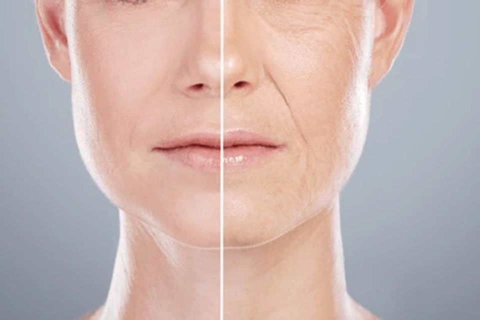 Anti aging 3