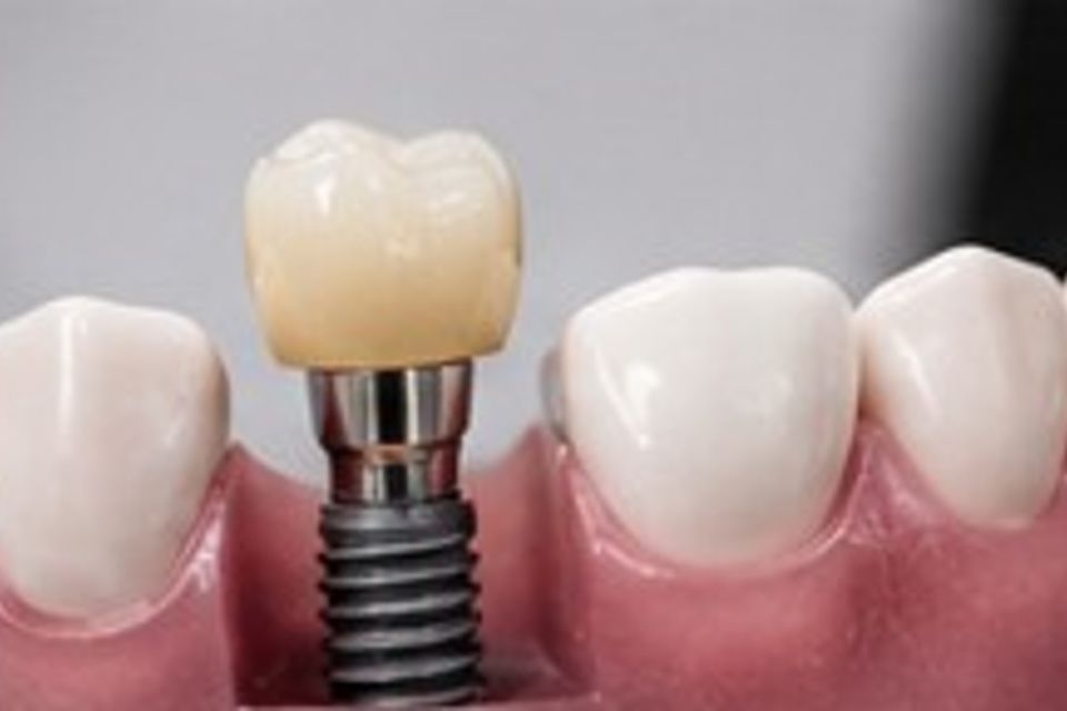 4th dental pics