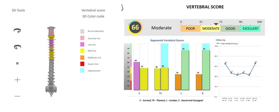 Vertebral load score