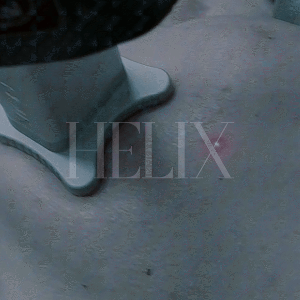 Helix Laser performed by Beauty Bomb Aesthetics