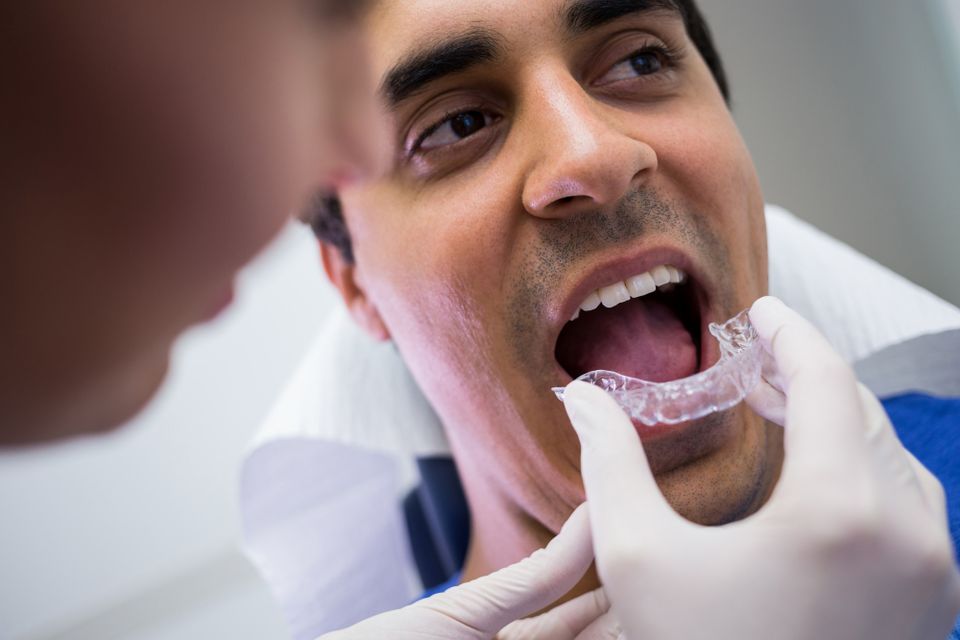 Clear aligners