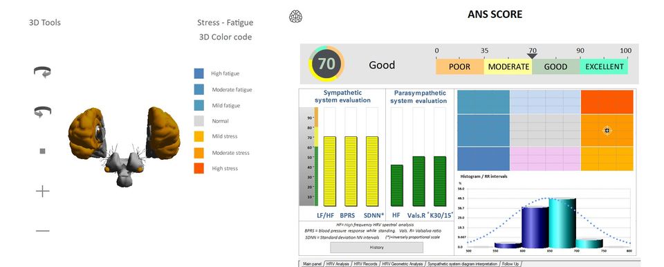 Stress score