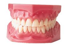 Complete or Full Dentures | Smileworks Meridian Idaho