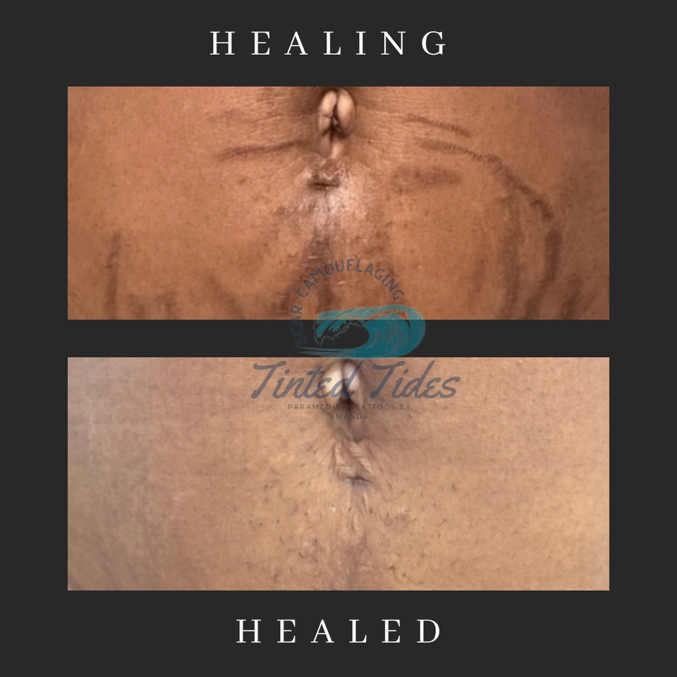 Black and white lash tech before and after instagram post