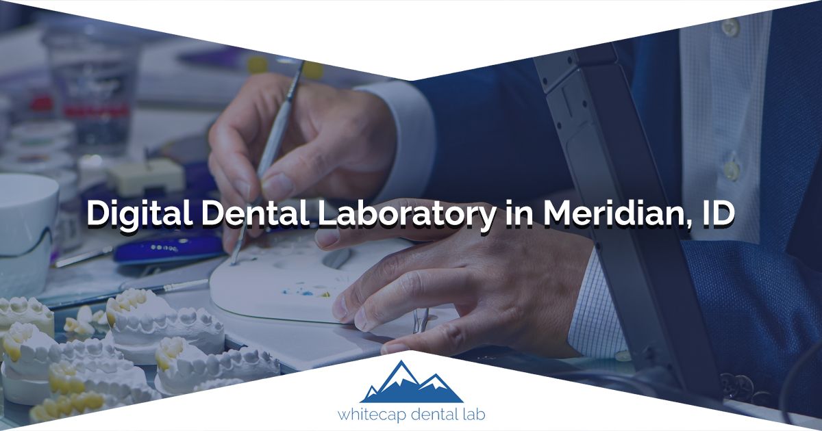 Whitecap Dental Lab: Digital Dental Laboratory in Meridian