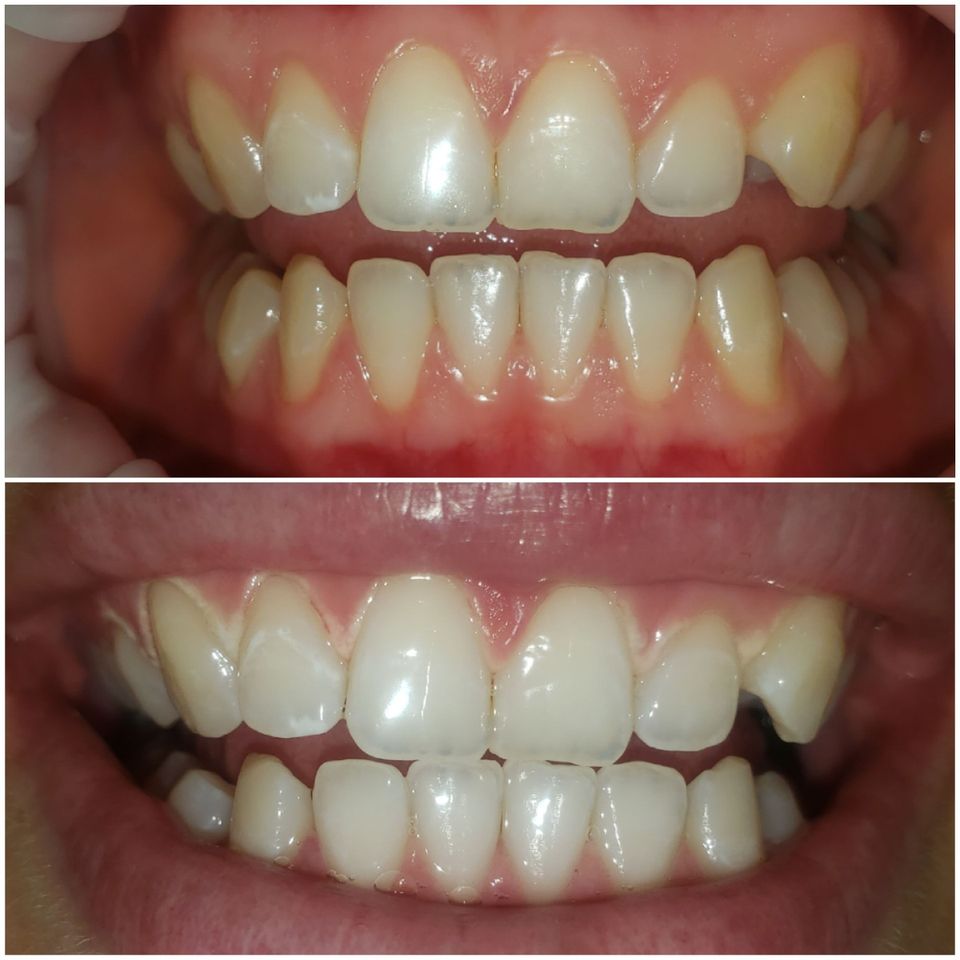 Beforeafter2