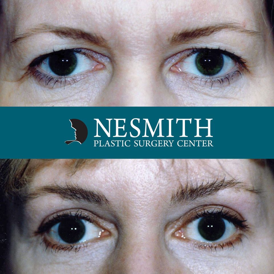 Nps social eyes 02