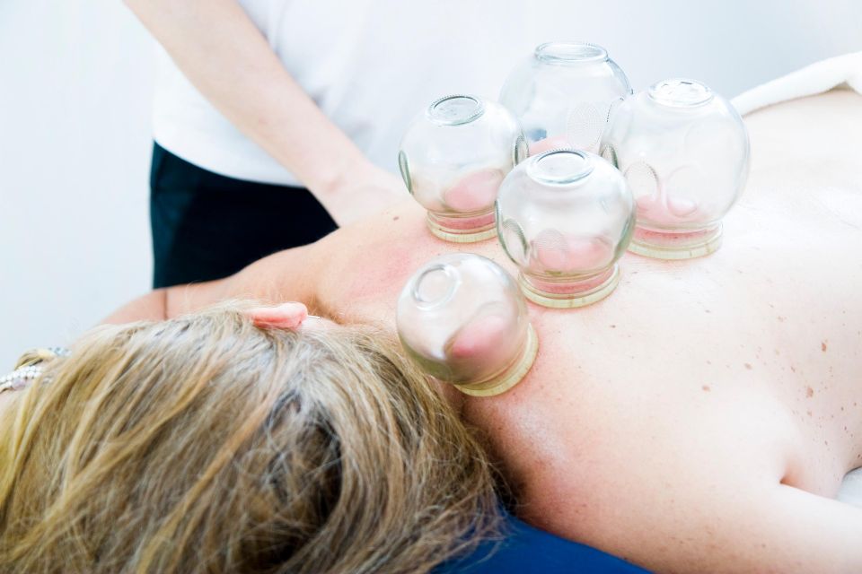 Mrgar cupping therapy gc15006d43 1920