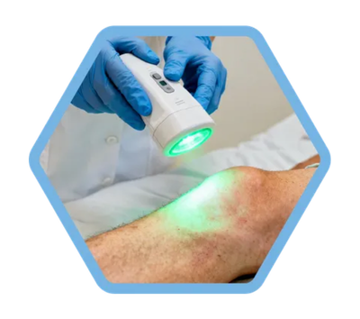 Northern wound therapies 5 original