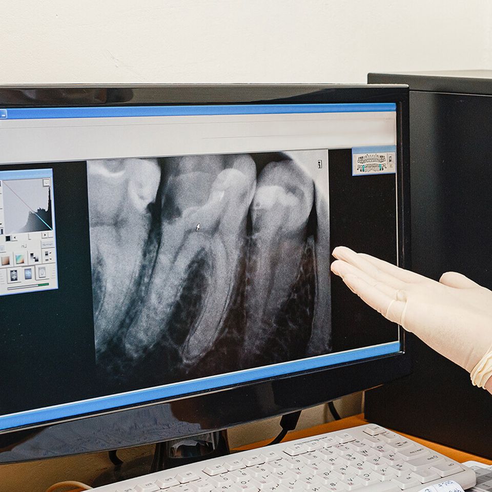 Humbertroaddentistry digitalxray
