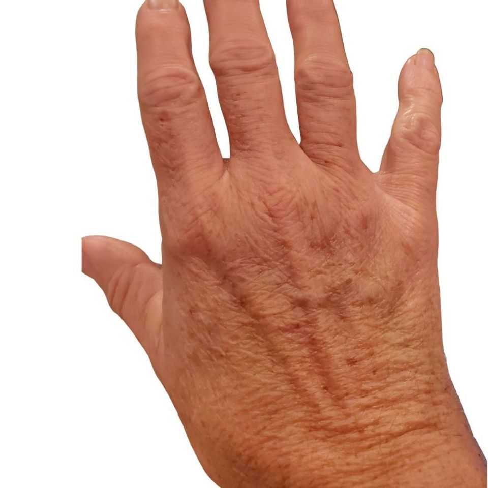 Before hand