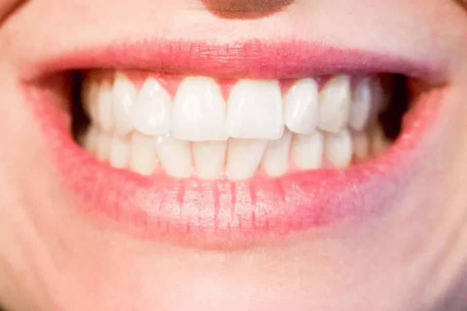 Teeth20170519 2252 77bvuf original