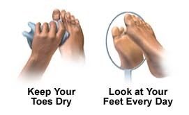 Diabeticfootcare