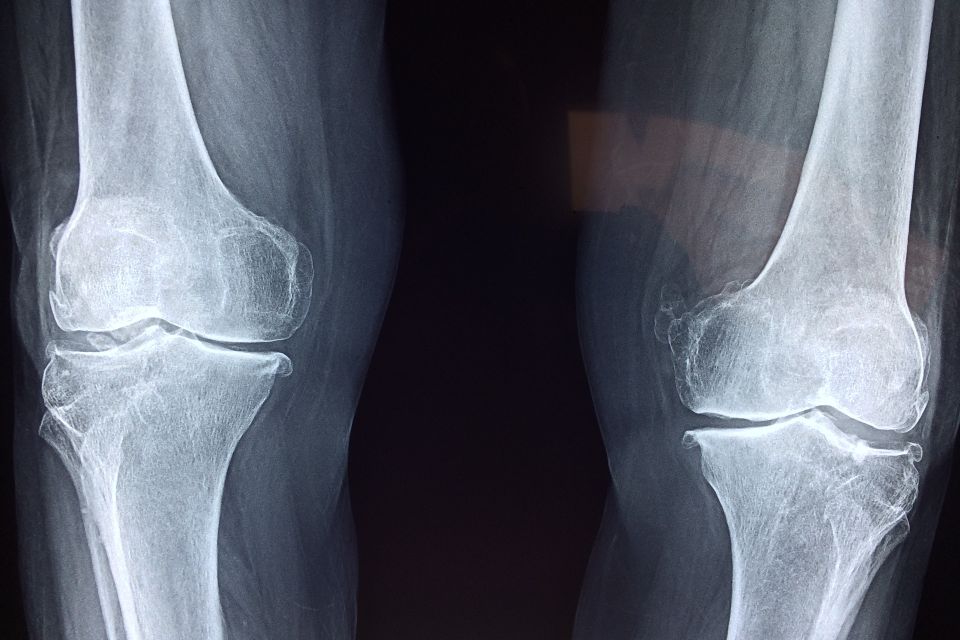 Knee g8399c50a0 1920