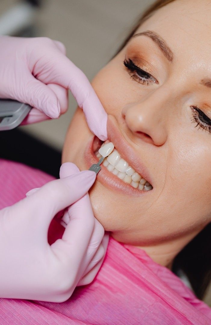 Veneer c