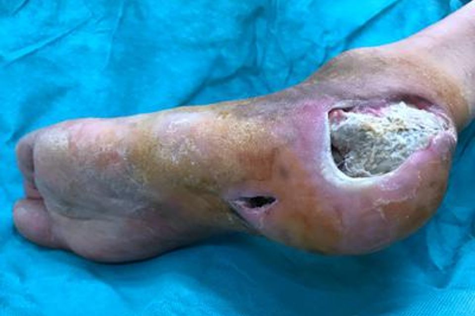 Case 1 before treatment