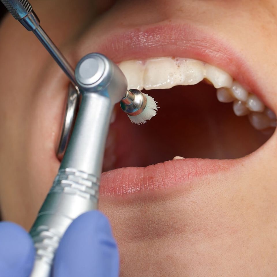 Humbertroaddentistry cleaning