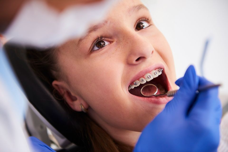 Early Orthodontic services