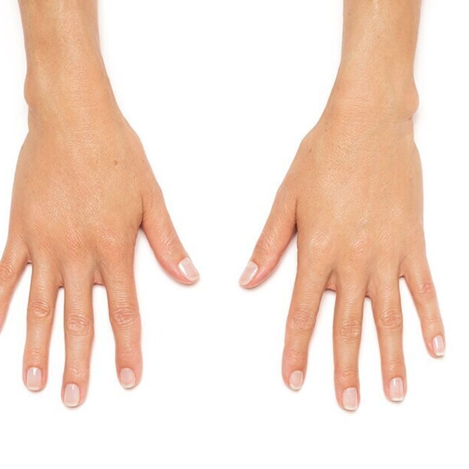 Andrea hands after