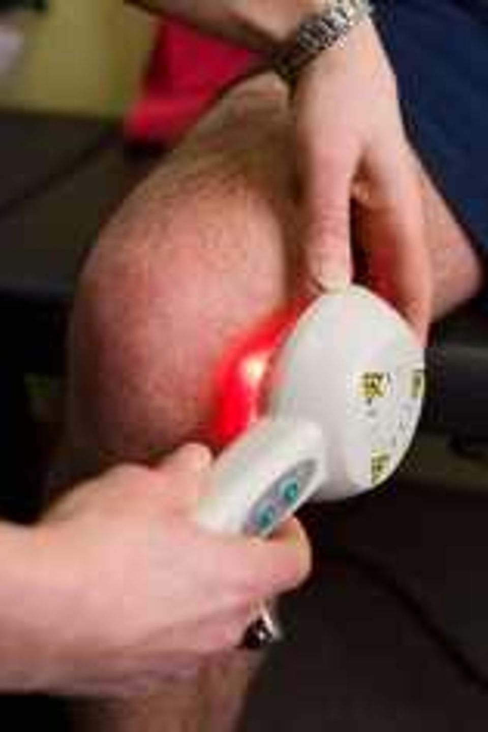 Laser knee