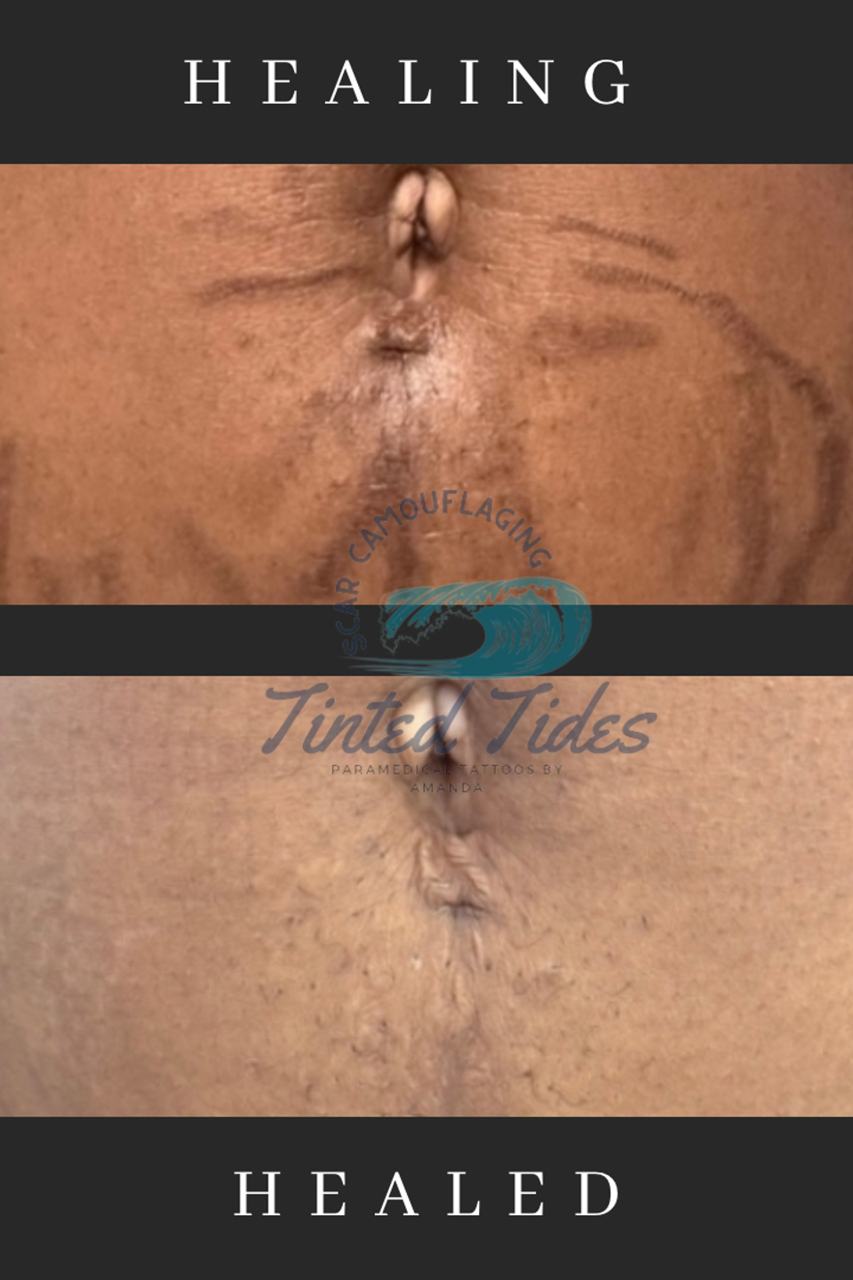 Black and white lash tech before and after instagram post