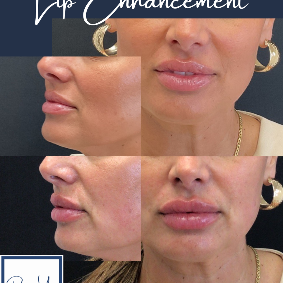 Lips   4