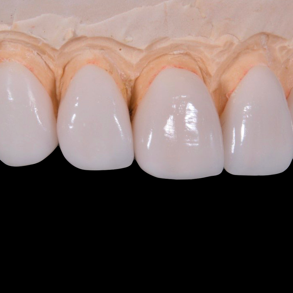Dental g51cc9eba1 1920