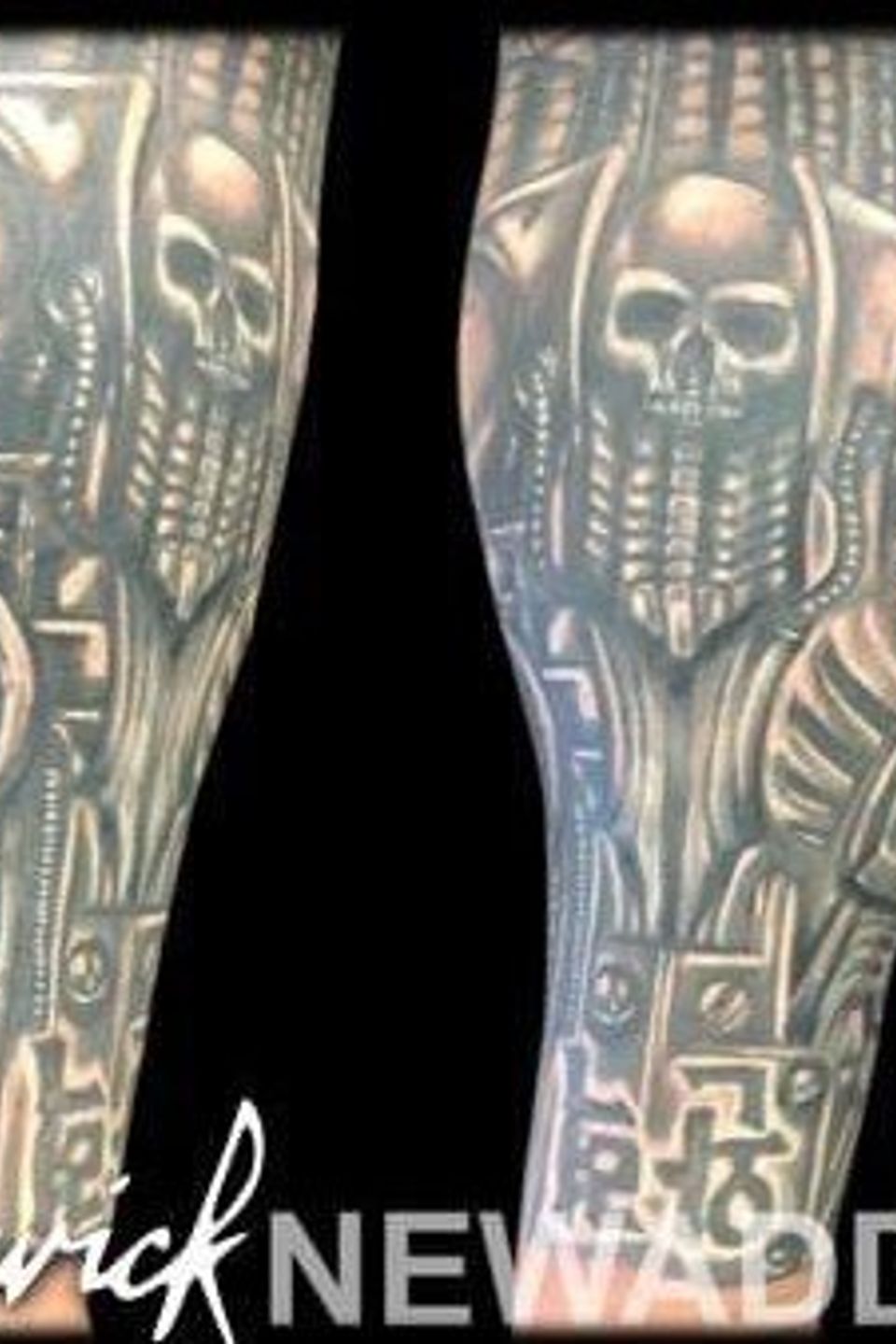 Adrian biomechanical sleeve