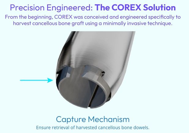 Corex 6