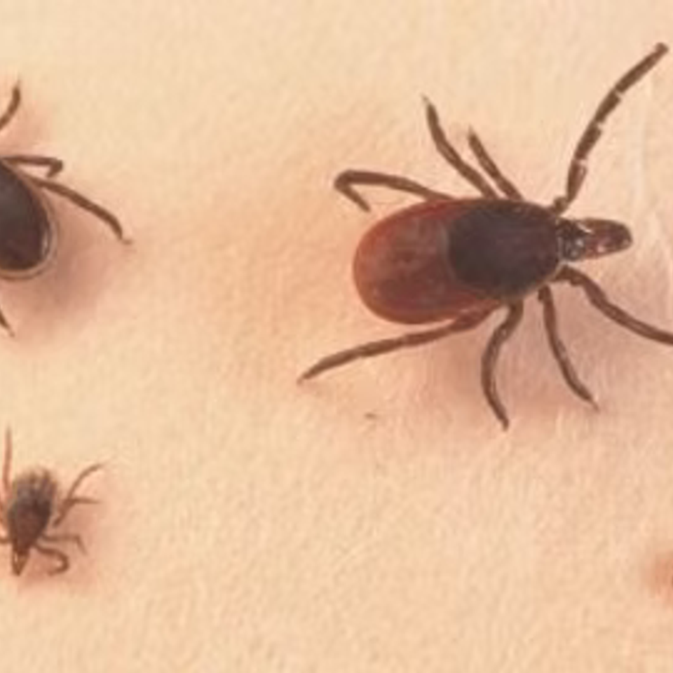 Pest3