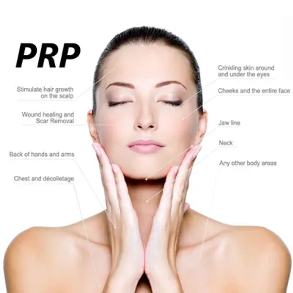 Prp for facial rejuvenation 640w original