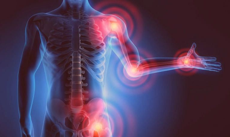 Joint pain caused by cad