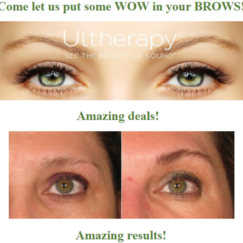 Ultherapy