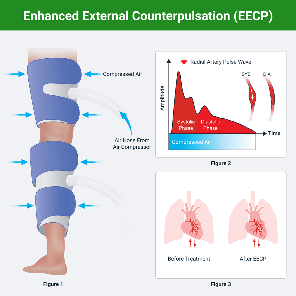 Eecp infographic