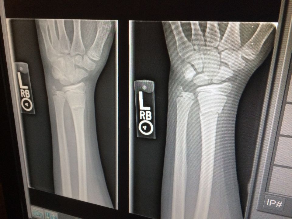 X ray gc1d3c9a11 1920