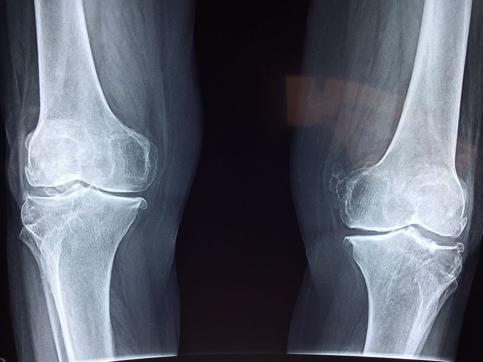 Knee eb37b40c28 1920