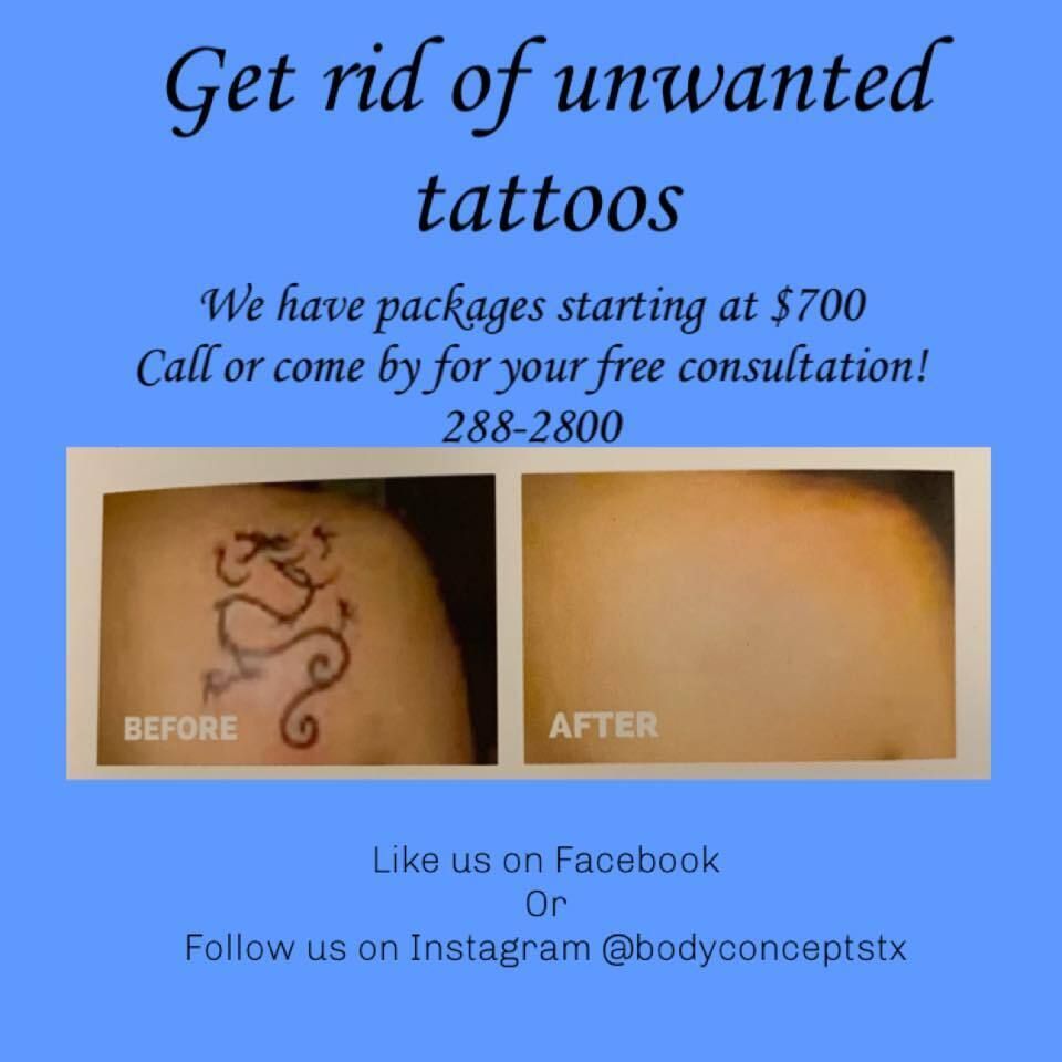 Tattoo removal