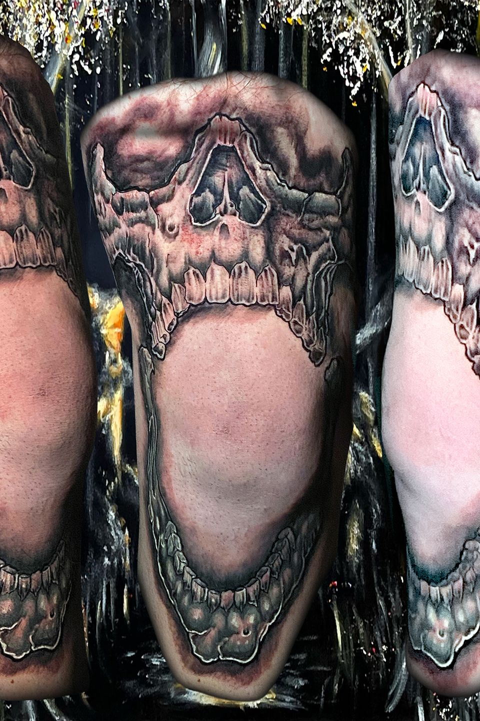 Josh skull on knee copy