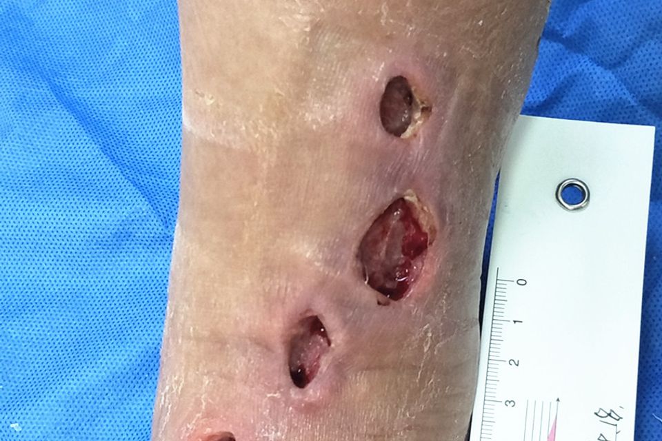 Case 4  after use 