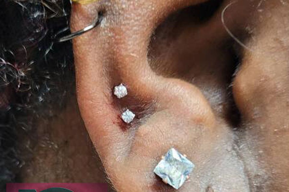 Barb double snug helix