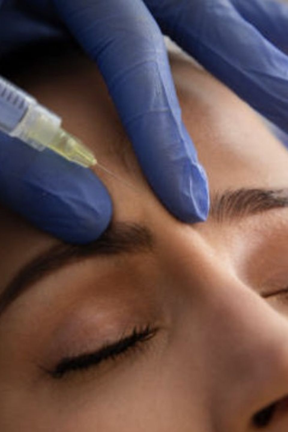 How Botox works to relax facial muscles for a youthful look in Granite Bay