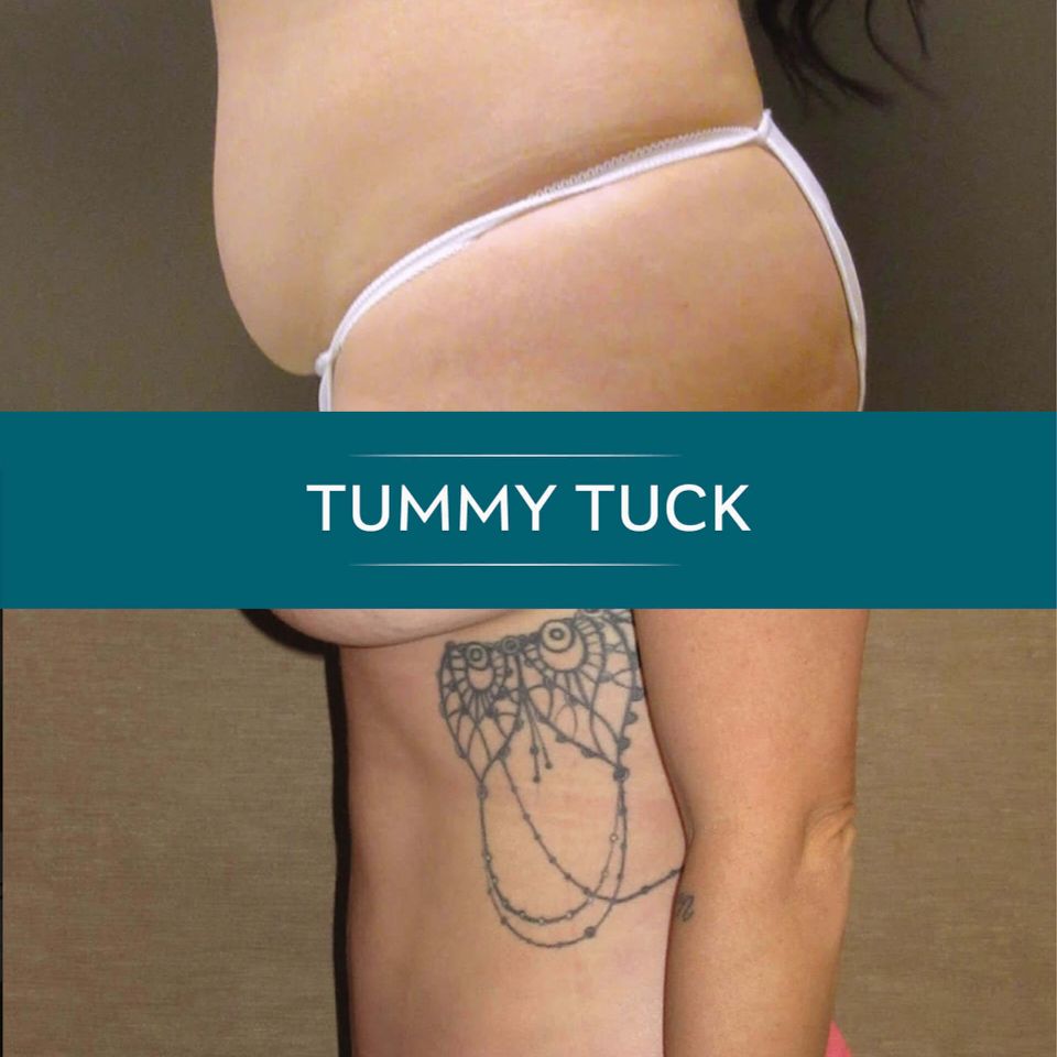 Nps social tummy 01
