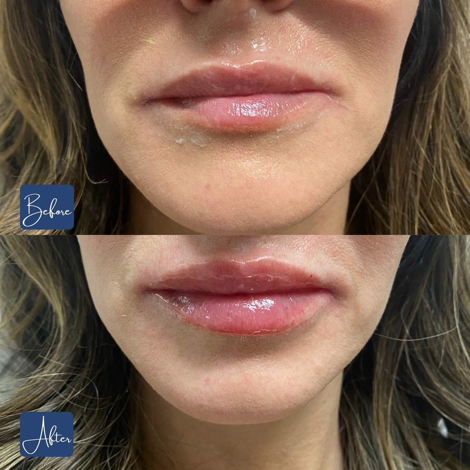 Lips  11