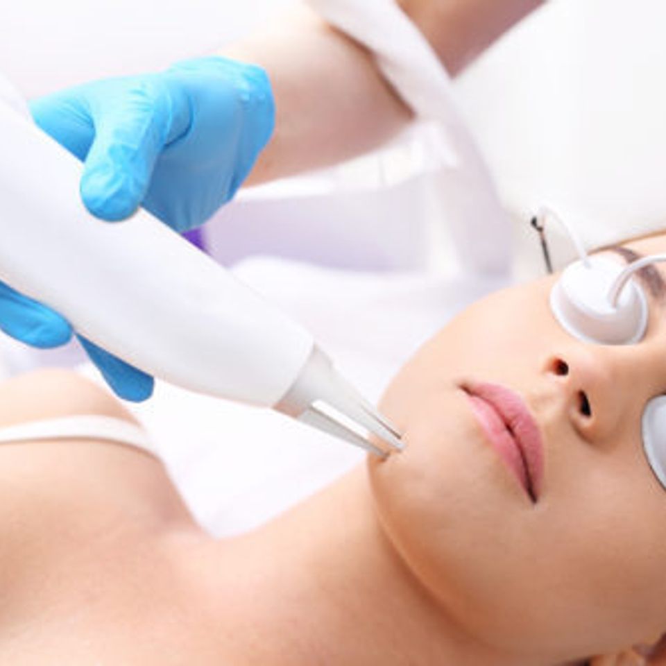 Facial treatment patient e1576009223870