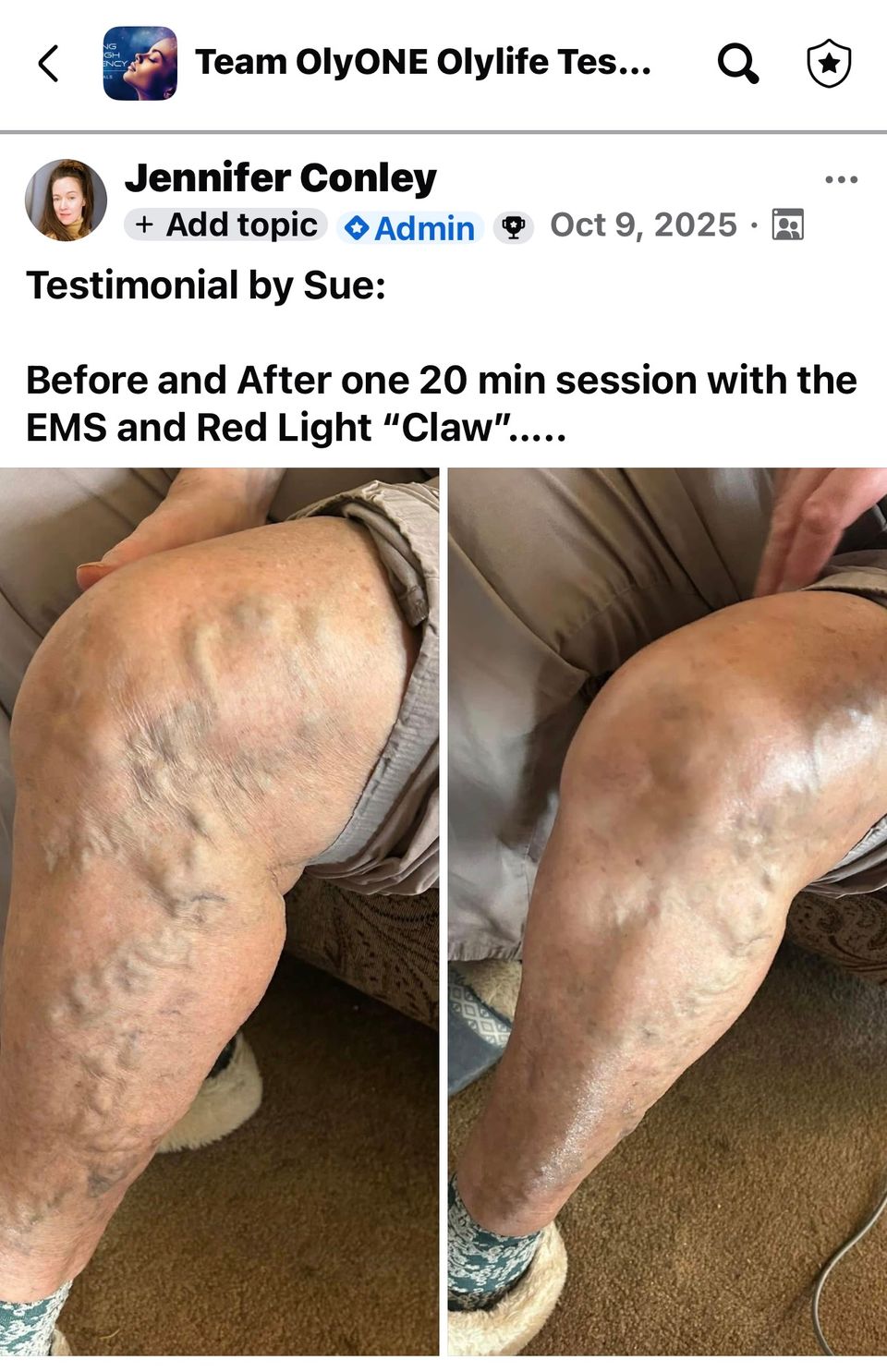 Sue fb ems red light knee