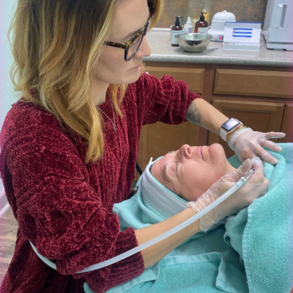 Microdermabrasion1