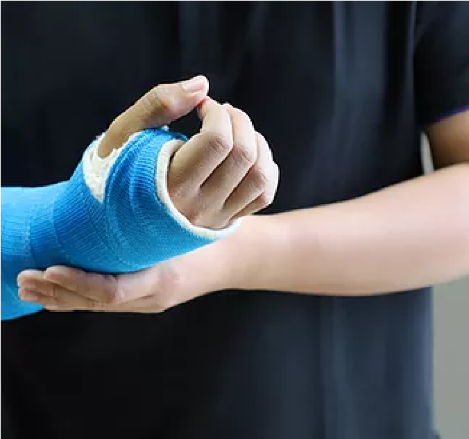 Hand, Wrist, Elbow Injuries & Disorders Treated By Orthopedist, Pasadena, CA