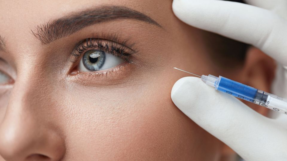 Under eye prf 2