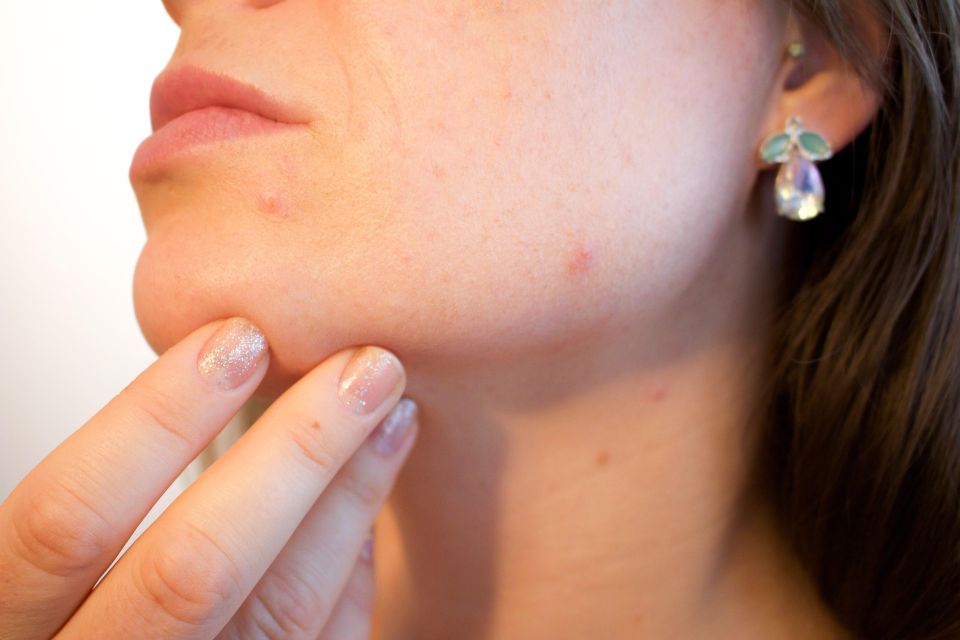 Acne g60819e881 1920